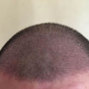 发际线分享社区