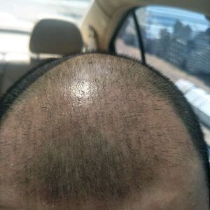 发际线分享社区