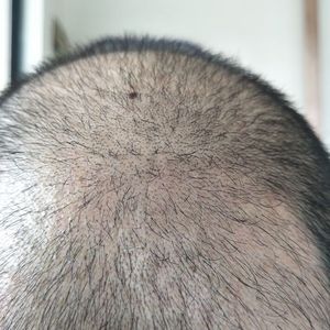 稀少加密分享社区