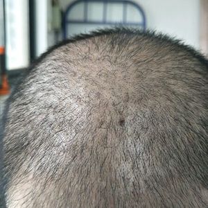 稀少加密分享社区