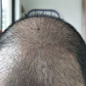 稀少加密分享社区