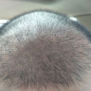 发际线分享社区