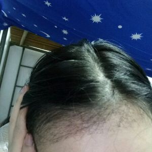 发际线分享社区