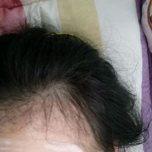 发际线分享社区
