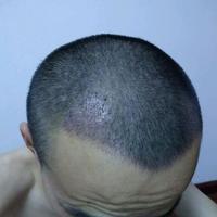 <font color="red">稀少加密</font>用戶圖片
