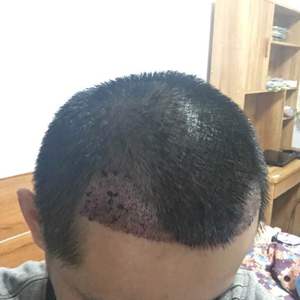 发际线分享社区