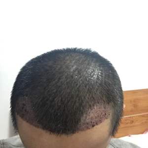 发际线分享社区