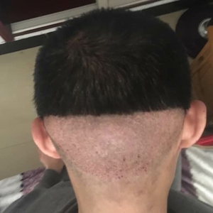 发际线分享社区