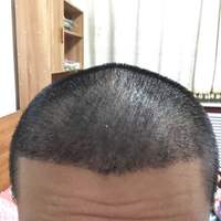 <font color="red">稀少加密</font>用戶圖片