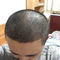 <font color="red">稀少加密</font>用戶圖片