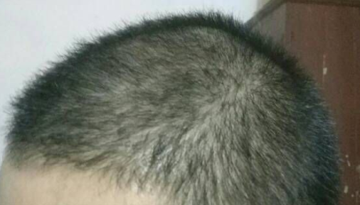 发际线分享社区