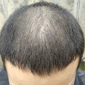 稀少加密分享社区