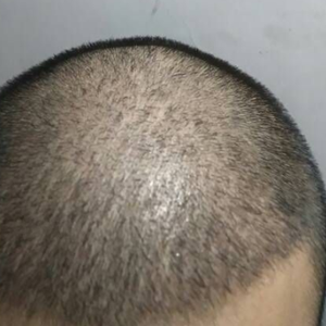 发际线分享社区