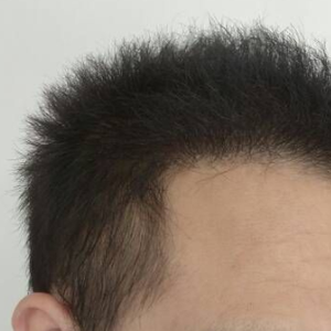 发际线分享社区