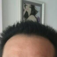 <font color="red">稀少加密</font>用戶圖片