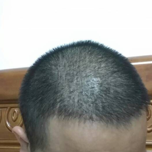 发际线分享社区