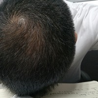 <font color="red">稀少加密</font>用戶圖片