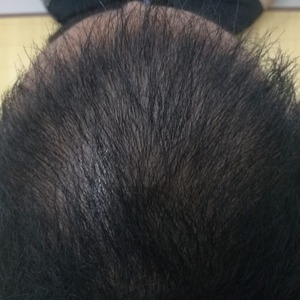 发际线分享社区