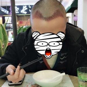 发际线分享社区