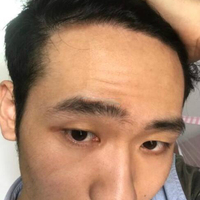<font color="red">稀少加密</font>用戶圖片