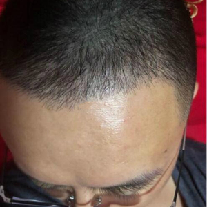 发际线分享社区