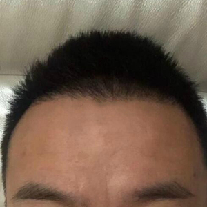 发际线分享社区