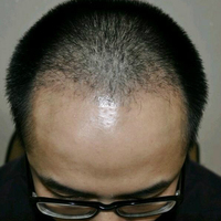 <font color="red">稀少加密</font>用戶圖片