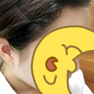 发际线分享社区
