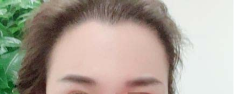 发际线分享社区