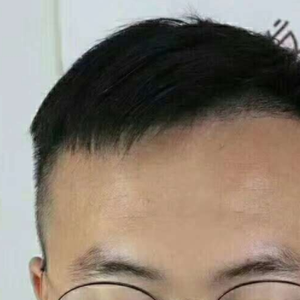发际线分享社区