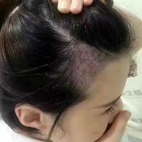 <font color="red">稀少加密</font>用戶圖片