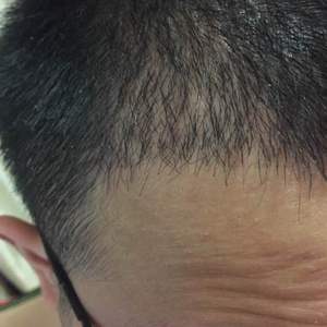 发际线分享社区