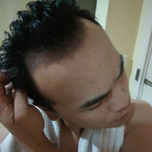 发际线分享社区