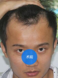 发际线分享社区