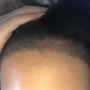 发际线分享社区