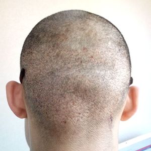 发际线分享社区