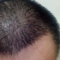 <font color="red">稀少加密</font>用戶圖片
