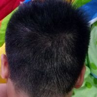 <font color="red">稀少加密</font>用戶圖片