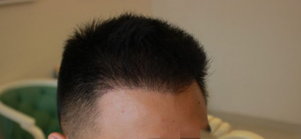 发际线分享社区