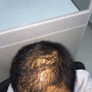 稀少加密分享社区