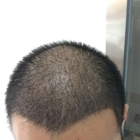 <font color="red">稀少加密</font>用戶圖片