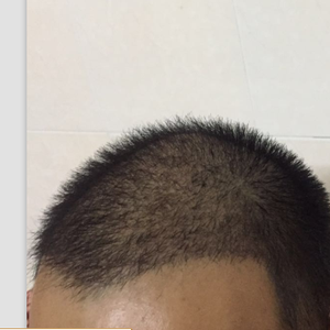 稀少加密分享社区