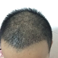<font color="red">稀少加密</font>用戶圖片