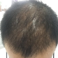 <font color="red">稀少加密</font>用戶圖片
