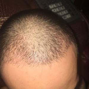 发际线分享社区