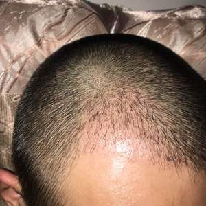 发际线分享社区