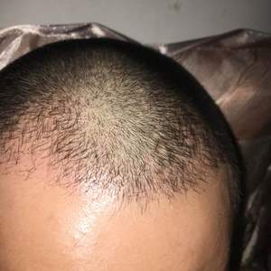 发际线分享社区