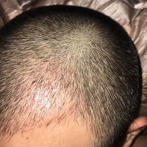 发际线分享社区