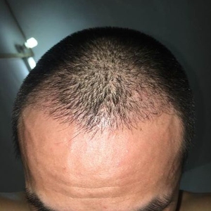 发际线分享社区
