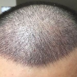 发际线分享社区